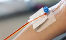 Iron Infusion Therapy Near Duxbury, MA: What to Know
