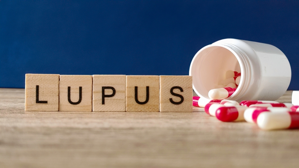 Lupus & Autoimmune Disease Specialist Near Marshfield & Pembroke, MA: Treatment and Infusion Options